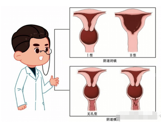 i型闭锁患者的阴道上端,宫颈和宫体发育正常,因子宫内膜发育好,症状