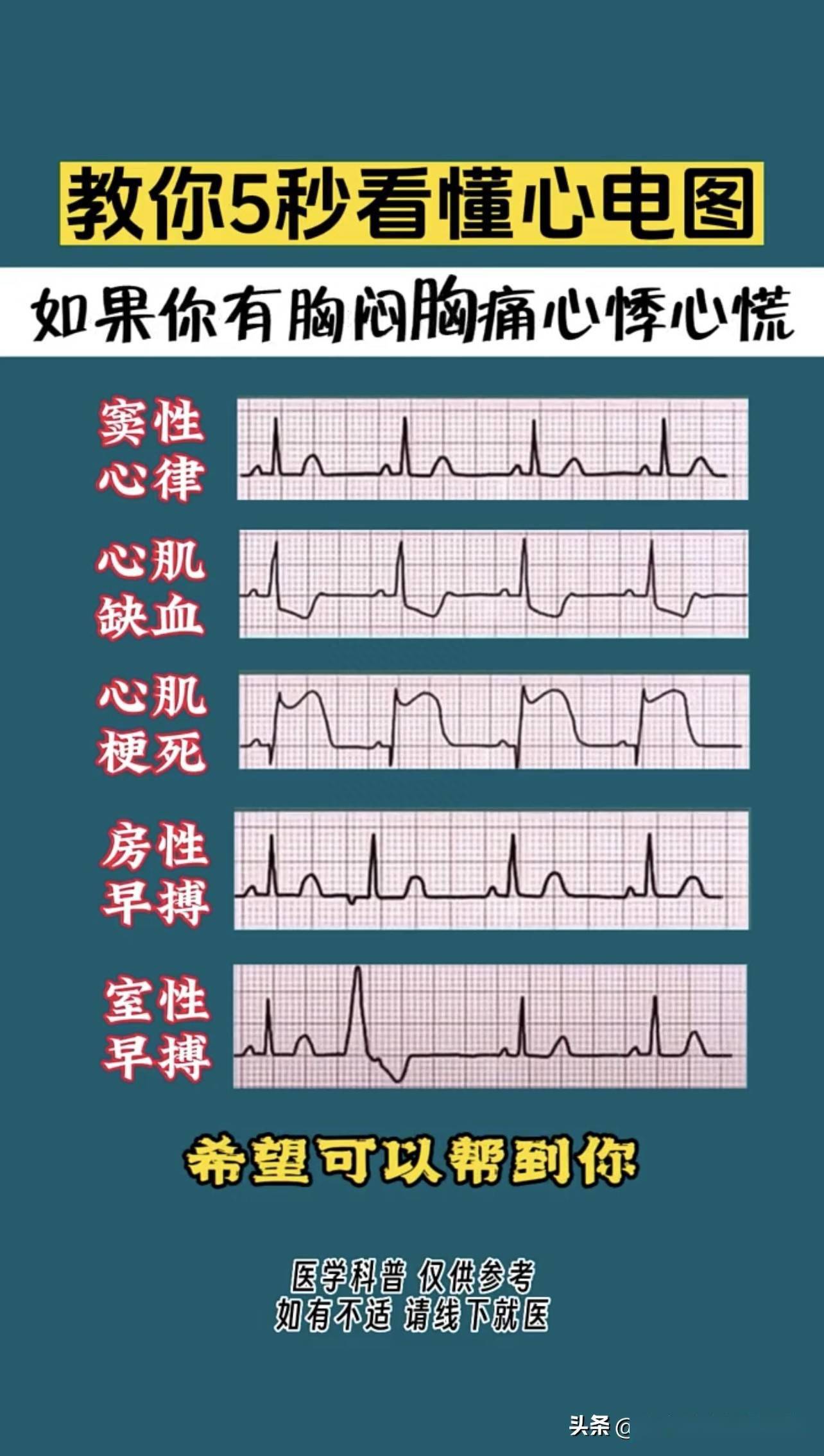 额窦图片