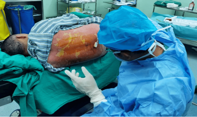 硬膜外神经阻滞有效治疗顽固性银屑病1例_患者_全身_诊断