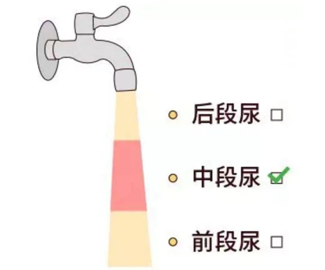 各种尿标本的的正确留取方法,护士你的宣教到位了吗?_尿液_容器_小时