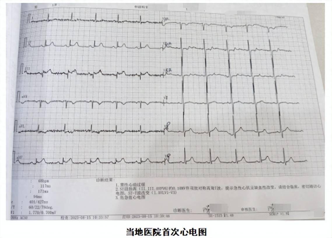 濮阳市人民医院胸痛中心再次刷新急性心梗救治时间记录_患者_心电图