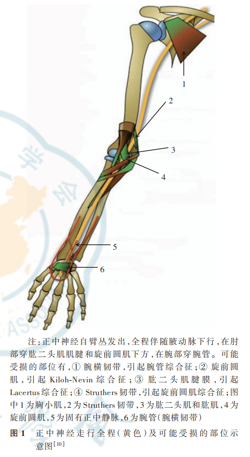 正中神经阻滞疗法中国疼痛学与麻醉学专家共识（2023 版）（中华疼痛学