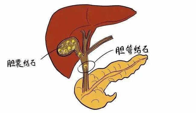 胃疼是什么原因导致的？这四个因素造成早发生早治疗