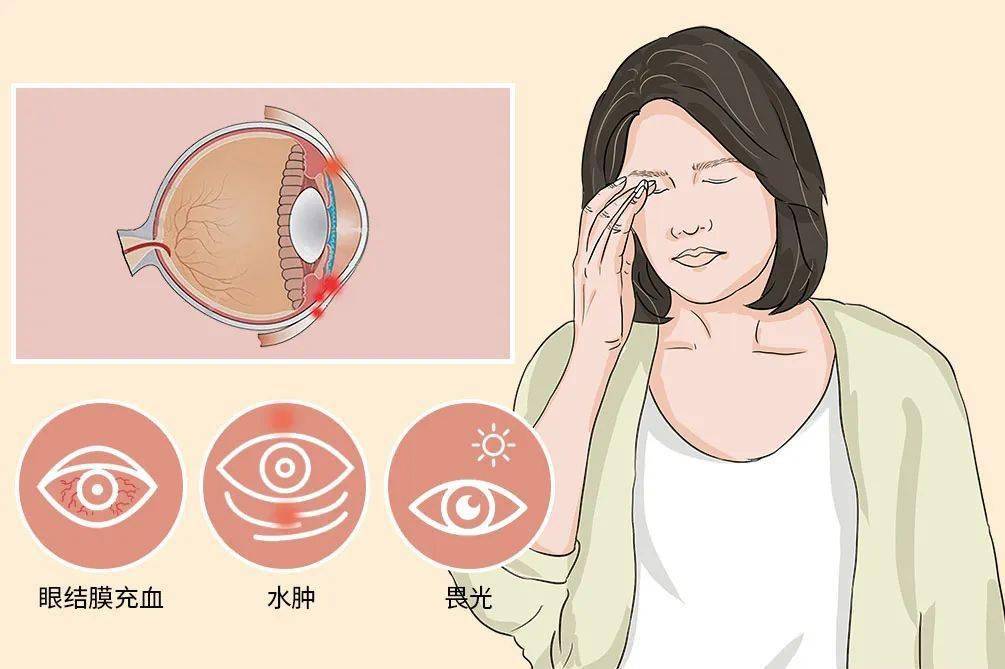 急性出血性结膜炎到底该如何科学防护?_发病_传播_患者