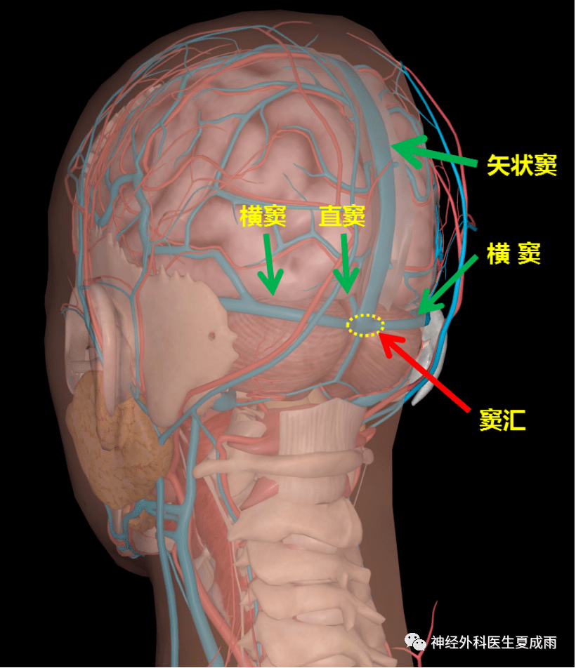 横窦乙状窦图片