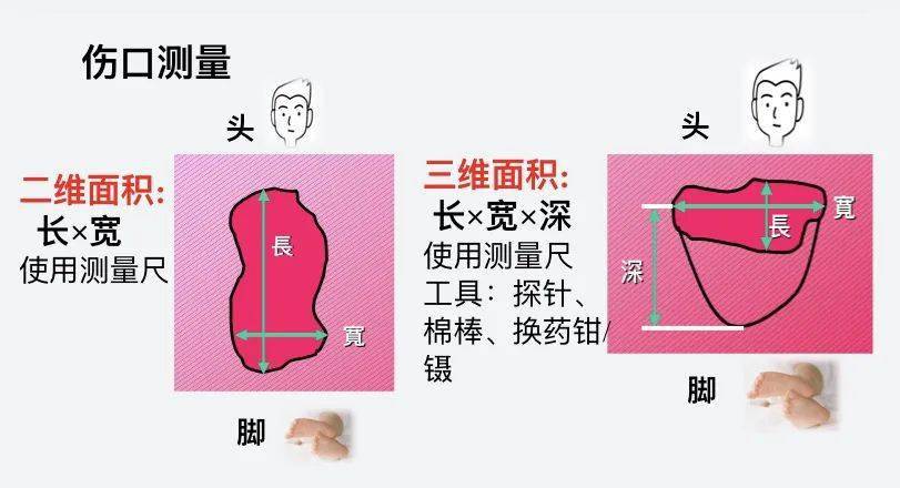 压力性损伤|伤口的测量与记录_护理_评估_微信