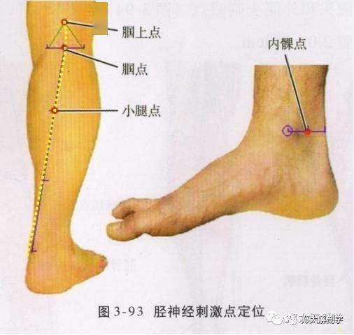 在此处可触及股动脉的搏动,在此向外1cm为股神经传出腹股沟韧带处