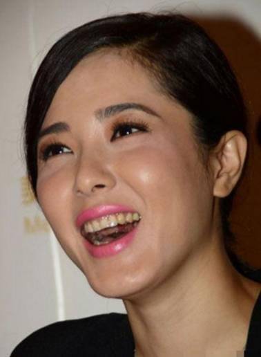 笑容_张柏芝_刘亦菲