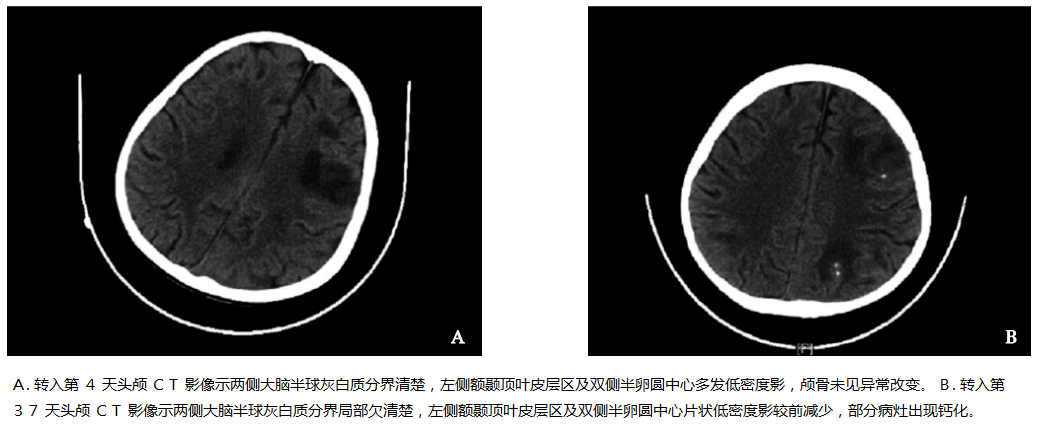 鼻脑毛霉菌病图片