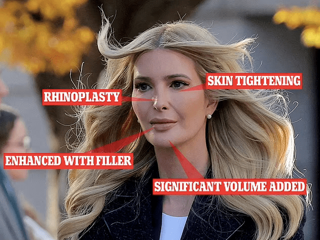 前美国第一千金伊万卡大变样,才42岁脸就要崩?