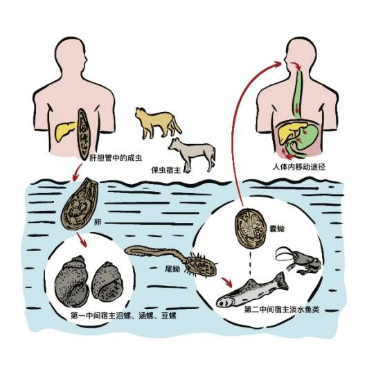 这种"瓜子状"虫竟然是i类致癌物!_肝吸虫_qian_淡水鱼