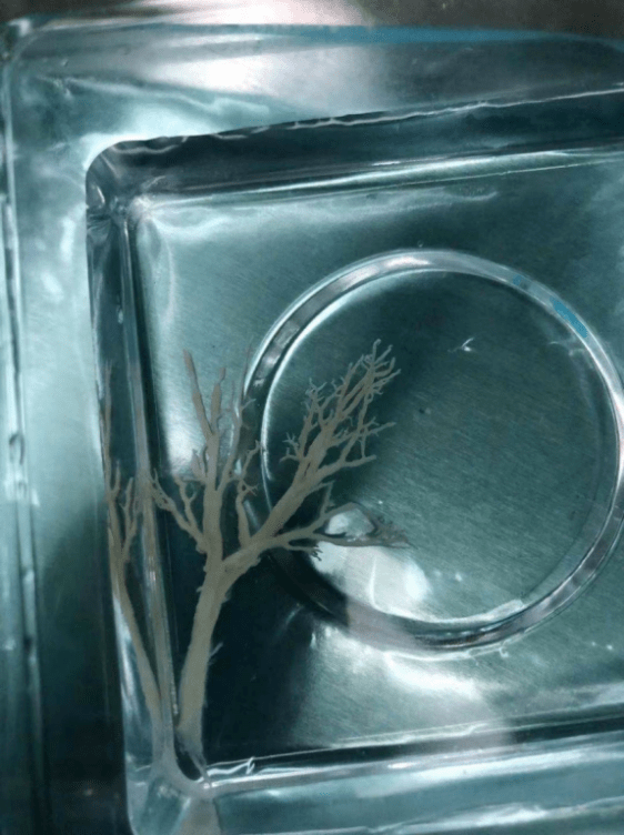 肺泡_支气管_治疗