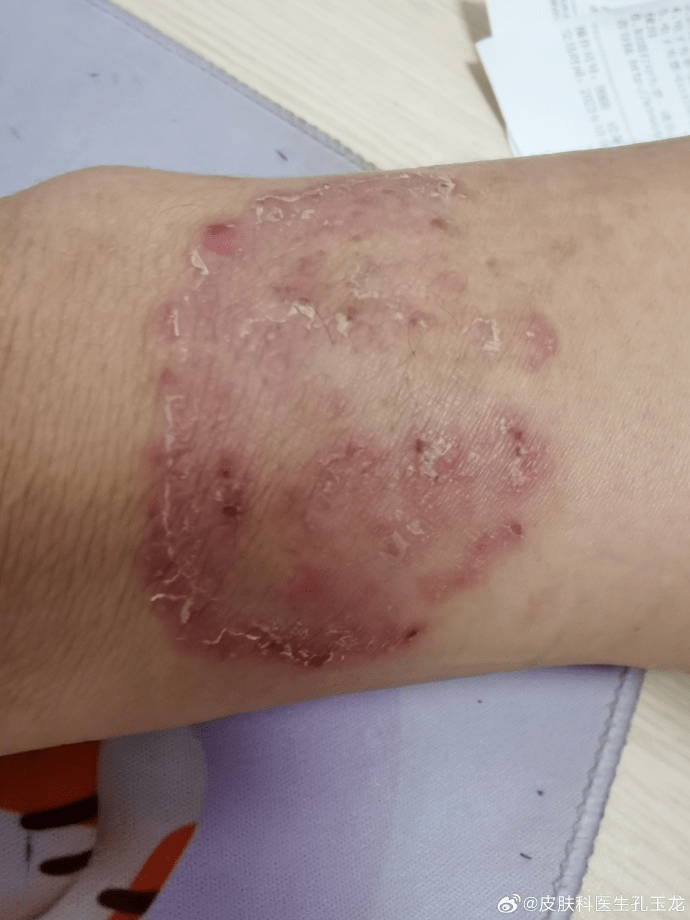 大厂一家医院的门诊故事:不要忽略每一个"小"状况.