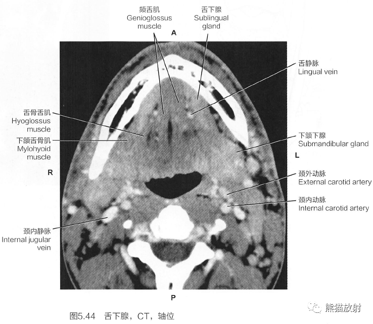 颌下腺ct断层解剖图片