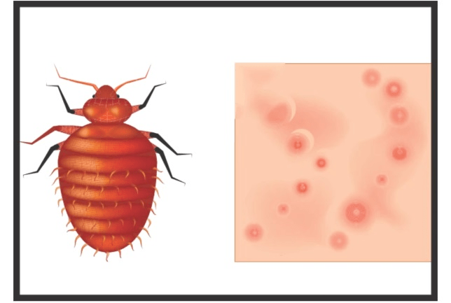 缝隙_床板_周边