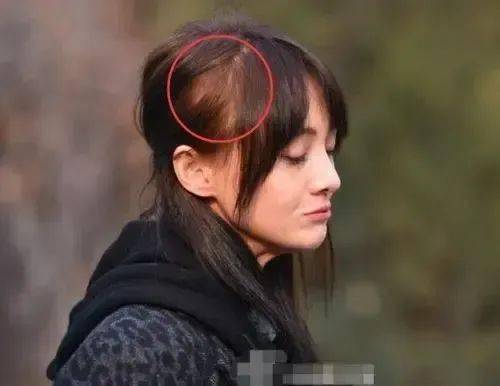 王凯任素汐?《一念关山》刘诗诗?圈内脱发的女明星?