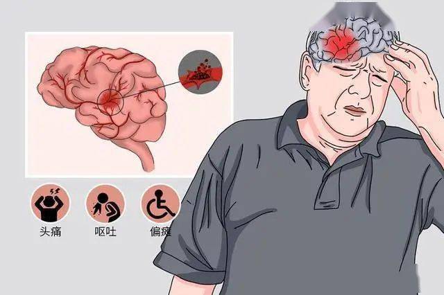 畢節疾控發佈冬季健康風險提示_人群_傳播_症狀