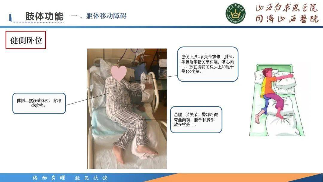 【ppt】一例高齡腦出血患者的康復護理個案分享_微信_郭玉麗_郭小娟