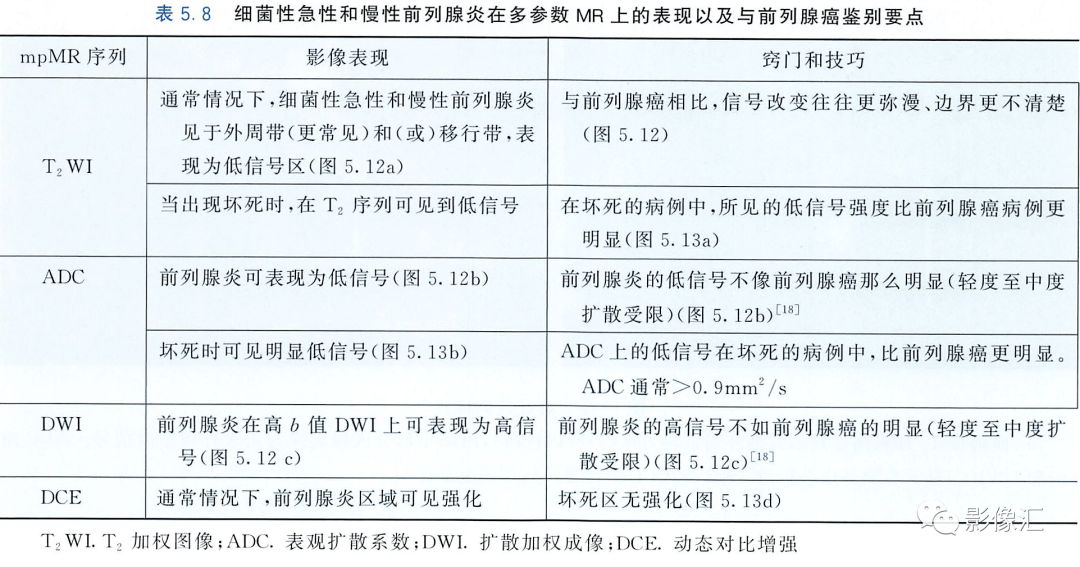 同樣,前列腺炎時也可見到增大的反應性淋巴結.