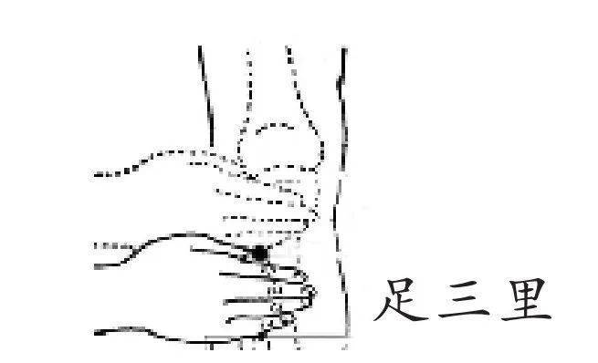 足三里穴為胃經之要穴,在臨床上常採用針刺足三里的方法治療胃痛,胃脹