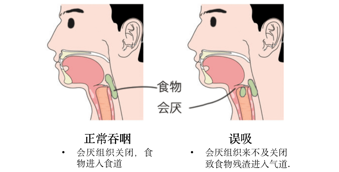 伸舌头看到会厌图片图片