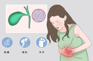【健康医声】胆道竟然会长蛔虫?_虫体_治疗_胆囊