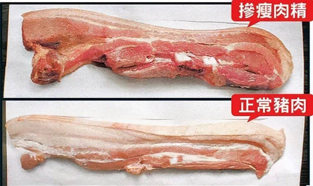 性食物中毒如旋毛虫,猪带绦虫,多见食用未煮熟的,含有寄生虫的猪肉或