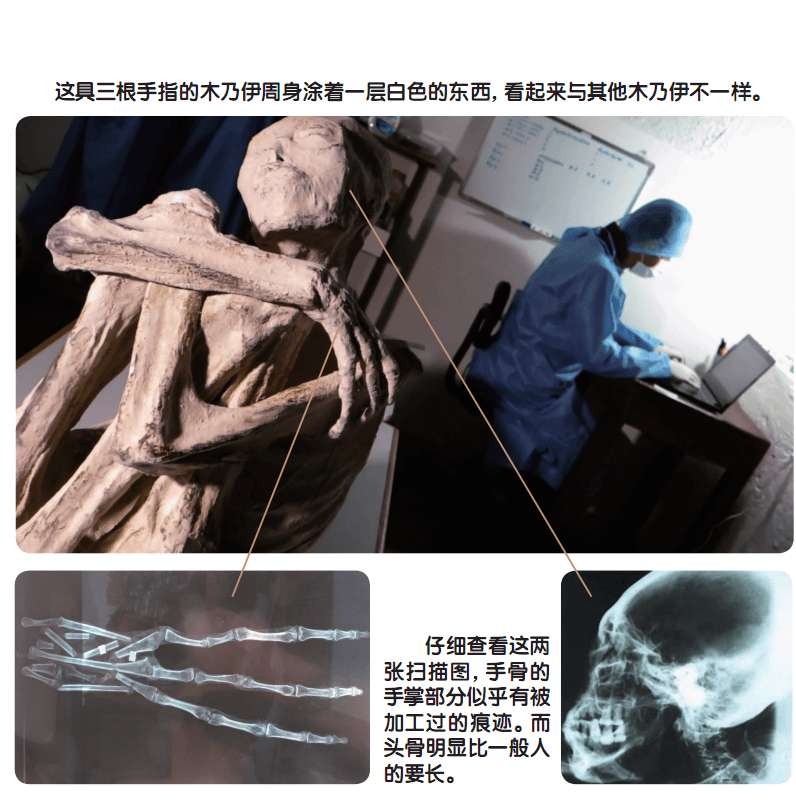 人類_科羅特_腳趾