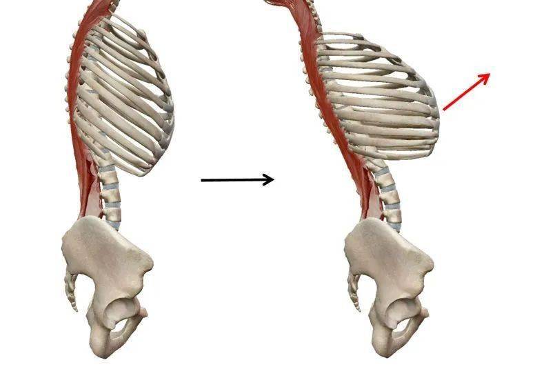 胸椎变形图片
